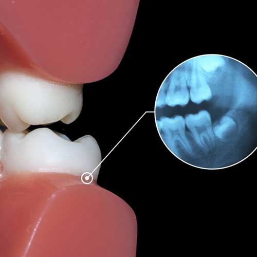 Diagnostik mit Laser und digitalem Röntgen